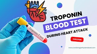 Troponin test for heart attack  Troponin I and Troponin T  Cardiac troponins  Trop t  Trop i [upl. by Nurav581]