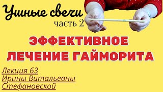 ЛЕЧЕНИЕ ГАЙМОРИТА ДОМА С ПОМОЩЬЮ УШНЫХ СВЕЧЕЙ Фитотерапия Выпуск 63 [upl. by Assirrec15]