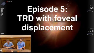 Retina Chats Episode 5 TRD with foveal displacement [upl. by Cyrille110]