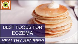 Best Foods for Eczema  Healthy Recipes [upl. by Kirven]