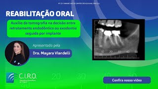 Decisão entre um retratamento endodôntico e exodontia com implantes [upl. by Ornie]