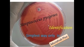 Streptococcus pyogenes identification [upl. by Dwan]