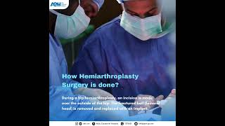 Hemiarthroplasty [upl. by Leonard]