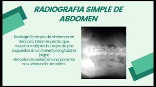 Enfermedad de Crohn Signos Radiológicos estudiantes de Bioimagen [upl. by Shara452]