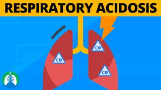 What are the Causes of Respiratory Acidosis  Respiratory Therapy Zone [upl. by Ahsei]