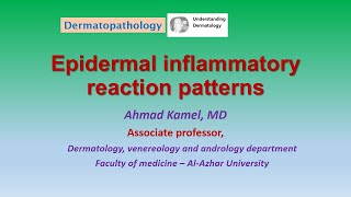 Epidermal inflammatory reaction patterns Dermatopathology [upl. by Lyred]