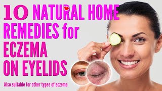 10 Best Natural Home Remedies for Eczema on Eyelids  how to treat eczema eyelids 2021 [upl. by Yelyak]