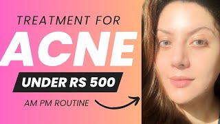 My Acne Routine for Under Rs 500  All Products Under Rs 500 [upl. by Assirroc315]