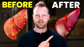 Cleanse amp Detox Liver with 1 Herb and Live a Long Health Life  Dr Alan Mandell DC [upl. by Demetria]