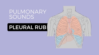 05  Lung Sounds  Pleural friction rub 🎧 [upl. by Philana]