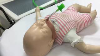 Securing the Paediatric Endotracheal Tube [upl. by Noreen513]