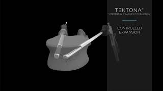 Spineart Tektona VFR [upl. by Sset580]