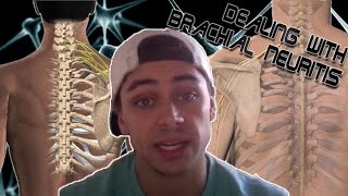 Brachial Neuritis Parsonage Turner My Experience History amp Recovery Update 3 [upl. by Atiuqan]