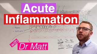 Acute Inflammation  Immunology [upl. by Elva]