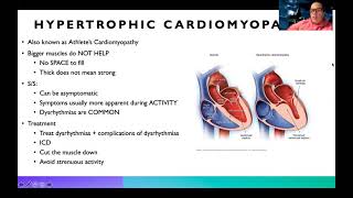 Complex Cardiomyopathies [upl. by Atsyrhc]