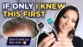 The Dermaroller Watch This BEFORE Microneedling What I wish I knew Before I Started Dermarolling [upl. by Zurkow]