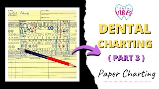 PAPER CHARTING FOR DENTAL ASSISTANTS  PART 3  Paper charting [upl. by Tav]