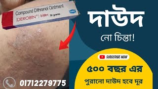 দাউদেরদাদ ও চুলকানির সবচেয়ে ভালো ঔষধ ডেরোবিনडेरोबिन क्रीम किस काम में आता है  দাদের ওষুধ Derobin [upl. by Veedis878]