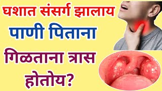 घशात खवखव होणे जळजळ होणे गिळताना त्रास होणे घरगुती उपायThroat IrritationSore Throat Home Remedies [upl. by Ettedanreb658]