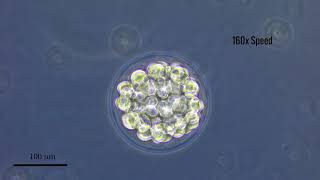 Fertilization amp Early Development of Lytechinus variegatus [upl. by Aerised87]