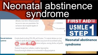 Neonatal abstinence syndrome in HindiUrdu by first aid for USMLE step 1 [upl. by Osbert]