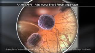 ABPS Autologous Blood Processing System [upl. by Ravert]