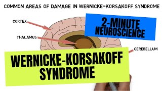 2Minute Neuroscience WernickeKorsakoff Syndrome [upl. by Canotas]