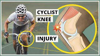 Prepatellar fascia injury also known as Cyclists knee explanation diagnosis and treatment [upl. by Enobe]