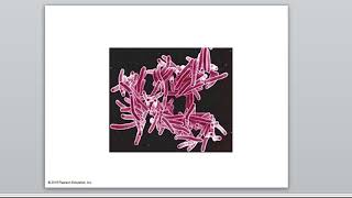 10 3 mycoplasmas and mycobacteria [upl. by Stalk377]