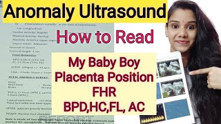 Anomaly Scan 20 weeks घर पर कैसे पड़े ।Anomaly Scan Baby Boy or Baby Girl How to Read level 2 report [upl. by Naujuj]