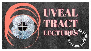 UVEAL TRACT lecture 8 TUBERCULOUS UVEITIS made easy [upl. by Mckeon]