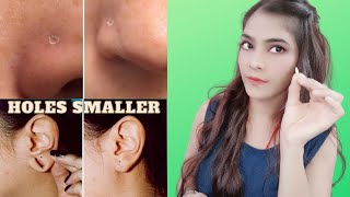 कान का छेद छोटा करे इस नुस्खे से करें  Nose Hole Small  Make Ear Holes Smaller [upl. by Leitao]