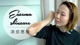 濕疹應援 Eczema amp Sensitive Skincare  高比 Gobby [upl. by Benco]