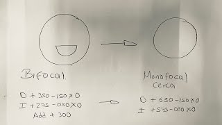 Conversión de bifocal a monofocal [upl. by Bettye430]