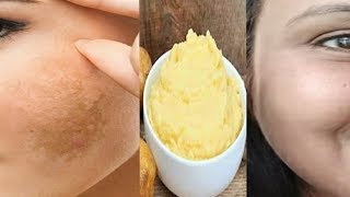 pigmentation home remedy get clear Spotless skin with this remedy kaurtips [upl. by Eugor828]