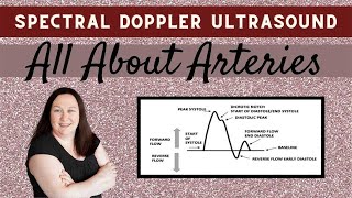 Spectral Doppler Ultrasound All About Arteries [upl. by Hiltan]