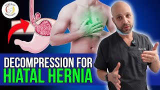 Pull Stomach Down From Diaphragm using Decompression for Hiatal Hernia [upl. by Jehiah]