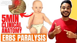 erbs paralysis clinical anatomy of brachial plexus  brachial plexus clinical anatomy [upl. by Ahsieyt557]