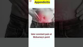 Appendix pain  appendicitis  shorts shortsfeed [upl. by Akiemahs]