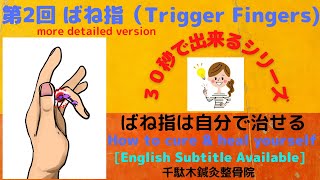 第2回 ばね指 自分治す、治し方（もっと詳しく編）Trigger Fingers How to Cure amp Heal Yourself more detailed version [upl. by Kelcie939]