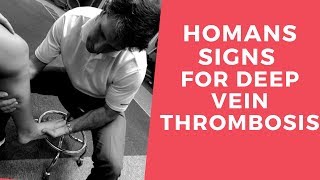 Homans Sign for Deep Vein Thrombosis [upl. by Bax]