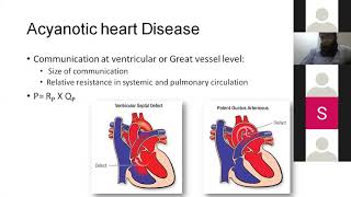 Acyanotic Heart Disease  Peads  Paediatrics Lecture  MBBS  Ample Medical Lectures [upl. by Eleanora]