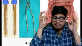 Kshar sutra kya hota hai  Kshar sutra treatment in ayurveda [upl. by Ylen309]