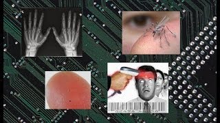 RFID CHIPChipen ohne dein Wissen Bedenkliche Zukunft [upl. by Assertal]