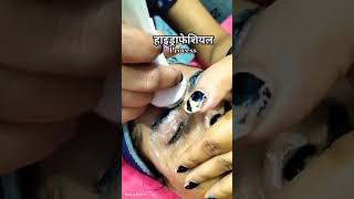 skin care treatmentdehydrated skinwith hydrafacialshortvideo [upl. by Grimbald]