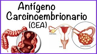 Antígeno Carcinoembrionario CEA [upl. by Otila558]