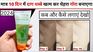 Patanjali Saundarya Aloe Vera Gel Review  aloe vera gel for face  aloe vera gal [upl. by Siwel462]