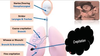 Respiratory System Examination in Newborn I Newborn Examination PART 6  Pediatrics [upl. by Nomled]