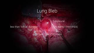 Lung Blebs Bullae [upl. by Elhsa457]