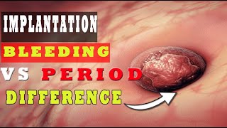 Implantation Bleeding Vs Period – How to Know the Difference 🩸🩸 [upl. by Oribel]